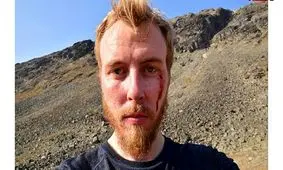 حمله خونین یک عقاب طلایی به چندین نفر در نروژ / می خواست کودک 20 ماهه را با خودش ببرد