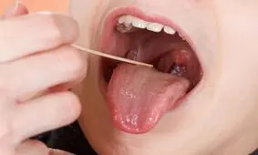 لوزه ها در سیستم ایمنی بدن چه نقشی دارند؟