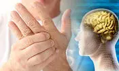 بیماری هزار چهره، مشهور ناشناخته
