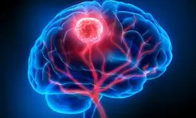 تشخیص و درمان سرطان بوسیله نور برای اولین بار در جهان