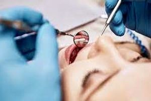 شکایت یک زن از دندانپزشک خود بعد از انجام ۳۲ عمل در یک جلسه!