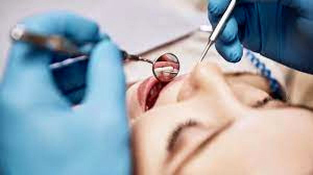 شکایت یک زن از دندانپزشک خود بعد از انجام ۳۲ عمل در یک جلسه!
