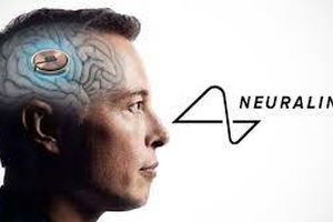 آغاز ساخت ایمپلنت در مغز انسان‌ها توسط ایلان ماسک/ ویدئو