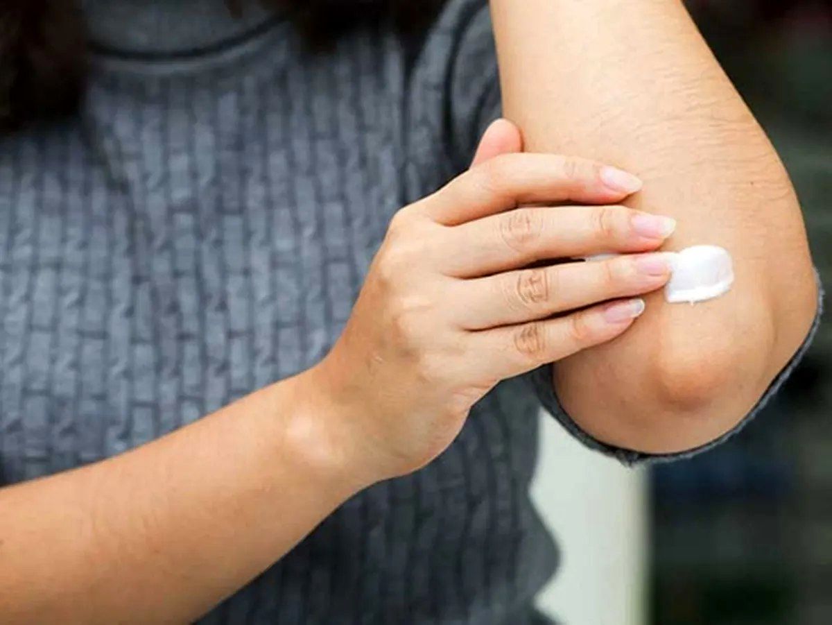 چرا پوست آرنج مستعد تیرگی است؟