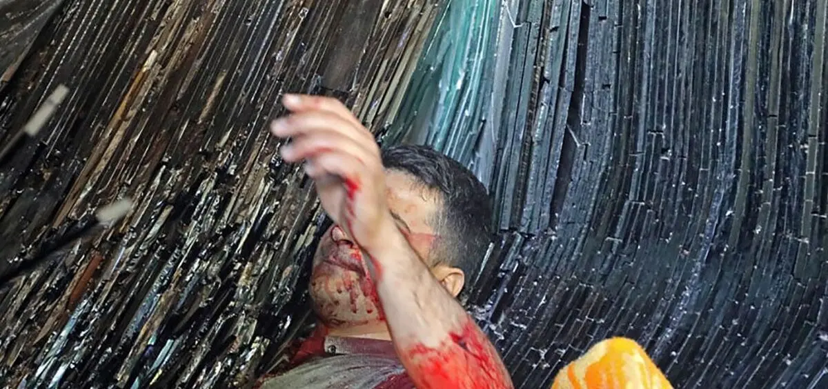 نجات معجزه آسای جوان مشهدی از حادثه 