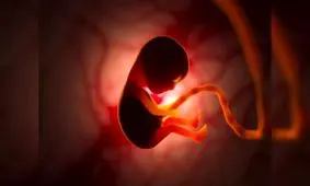 شکل صورت ما احتمالا ناشی از فشار رحم مادر است!

