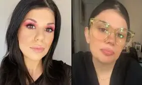 این زن اهل استرالیا ۵ اندام اضافی در بدن خود دارد