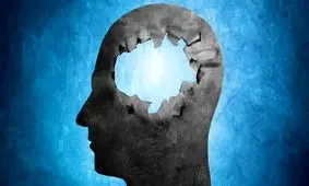 بهبود حافظه بیماران مبتلا به آلزایمر با کمک داروی ام‌اس!