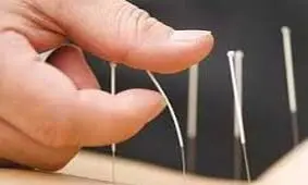 طب سوزنی می تواند به پیشگیری از دیابت کمک کند؟
