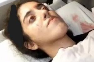 توضیح پلیس درباره ماجرای دختر ۲۰ ساله در تجمع میدان شهرداری رشت/ ویدئو