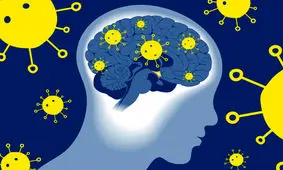 خطر تشنج پس از کووید ۱۹ بیشتر از آنفلوانزا