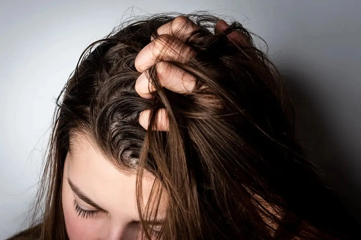 چگونه از چرب شدن پوست سر جلوگیری کنیم؟
