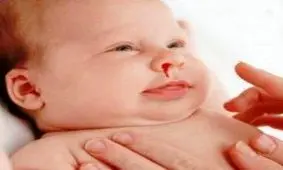 
علل خون دماغ نوزاد و کودک خردسال