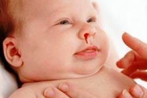 
علل خون دماغ نوزاد و کودک خردسال