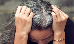 روش‌هایی ساده برای جلوگیری از سفیدی زودرس موهای سر