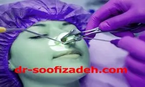 هر چیزی که میخواهید درباره عمل بینی بدانید