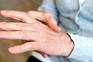 بهبود علائم آرتروز دست با دارویی مقرون به صرفه