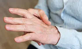بهبود علائم آرتروز دست با دارویی مقرون به صرفه