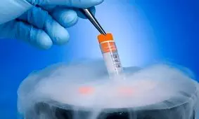 همه چیز درباره انجماد بافت بیضه 