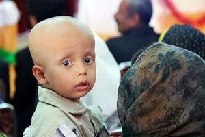 شایع ترین سرطان کودکان ایرانی چیست؟