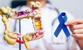 چه افرادی در معرض خطر سرطان روده هستند؟