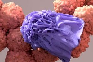 چگونه سلول های سرطانی را از بین ببریم؟/ ویدئو