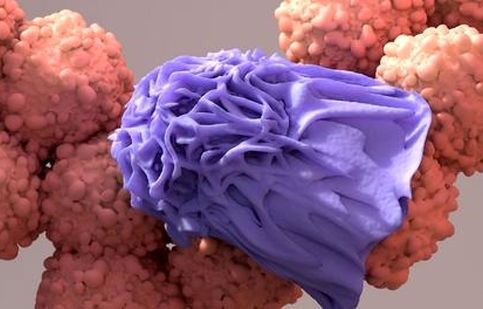 چگونه سلول های سرطانی را از بین ببریم؟/ ویدئو