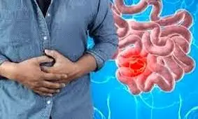 انسداد روده بزرگ؛ علائم، علت ها و درمان