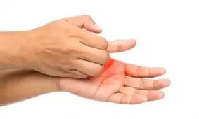 خارش کف دست، خبر از پول می‌دهد یا بیماری؟