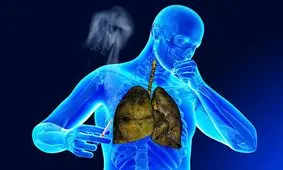 بلایی که سر ریه یک فرد سیگاری میاد!/ ویدئو