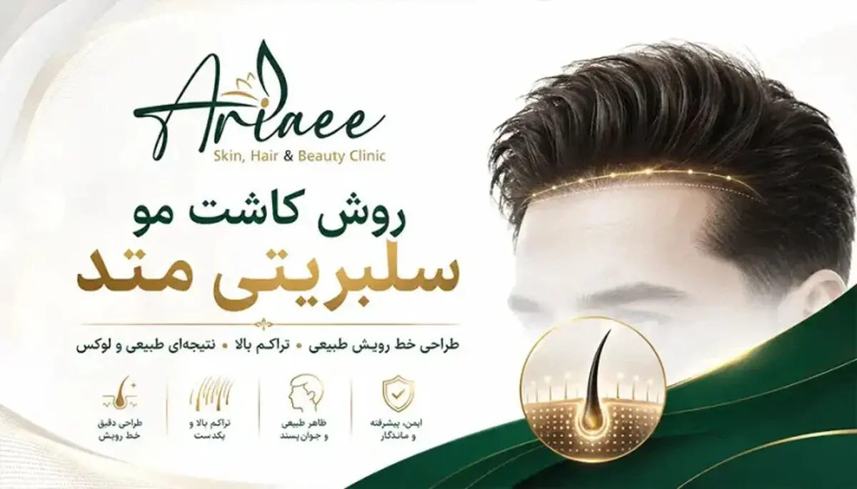 بهترین روش کاشت مو بدون تراشیدن سر و جای زخم؛ بررسی ماندگاری و تراکم بالا