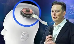 ایلان ماسک با تراشه Blindsight بینایی را به افراد نابینا برمی‌گرداند

