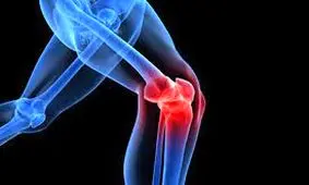 ۵ توصیه برای کاهش دردهای مفصلی در هوای سرد/ اینفوگرافیک