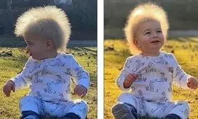 بیماری‌ای که موها را مانند یک گلوله کاه می کند