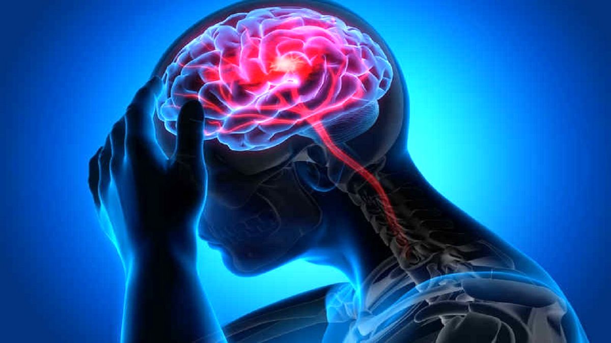 علائم سکته مغزی قریب الوقوع