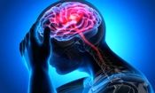 علائم سکته مغزی قریب الوقوع