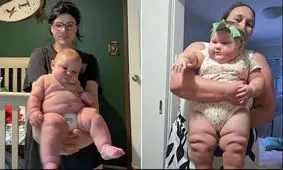 نگرانی از افزایش تولد نوزادان غول پیکر