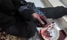 انفجار نارنجک دستی در ملارد؛ جوان مجروح به مرکز درمانی منتقل شد/ ویدئو

