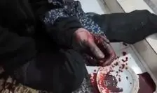 انفجار نارنجک دستی در ملارد؛ جوان مجروح به مرکز درمانی منتقل شد/ ویدئو

