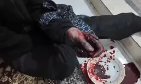 انفجار نارنجک دستی در ملارد؛ جوان مجروح به مرکز درمانی منتقل شد/ ویدئو

