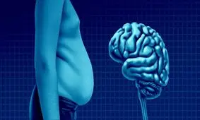 چاقی با مغز چه می کند؟
