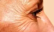 چگونه با افزایش سن از «پروتئین نگهدارنده بدن» مراقبت کنیم؟
