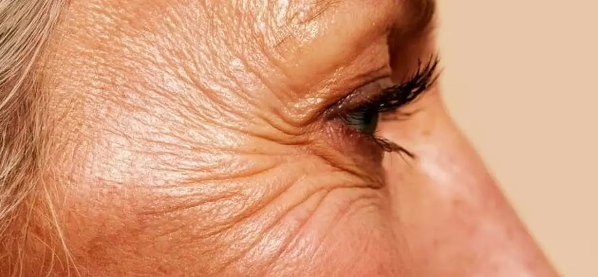 چگونه با افزایش سن از «پروتئین نگهدارنده بدن» مراقبت کنیم؟
