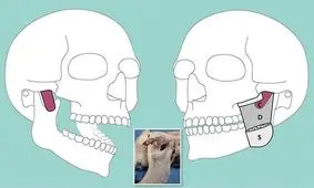 کشف لایه عضلانی جدیدی در فک انسان!