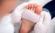 ابداع یک هیدروژل جدید برای درمان زخم‌های دیابتی

