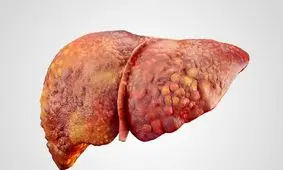  هپاتیت از طریق فوتبال منتقل نمی شود

