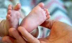 تولد حیرت انگیز دختر عجیب الخلقه/ با خنده هایش دنیا را شیفته خود کرد