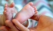 تولد حیرت انگیز دختر عجیب الخلقه/ با خنده هایش دنیا را شیفته خود کرد