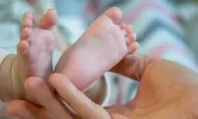 تولد حیرت انگیز دختر عجیب الخلقه/ با خنده هایش دنیا را شیفته خود کرد