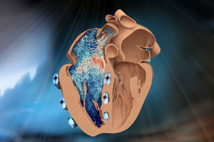 مهندسان دانشگاه «ام آی تی» یک نمونه رباتیک بطن راست قلب را طراحی کردند

